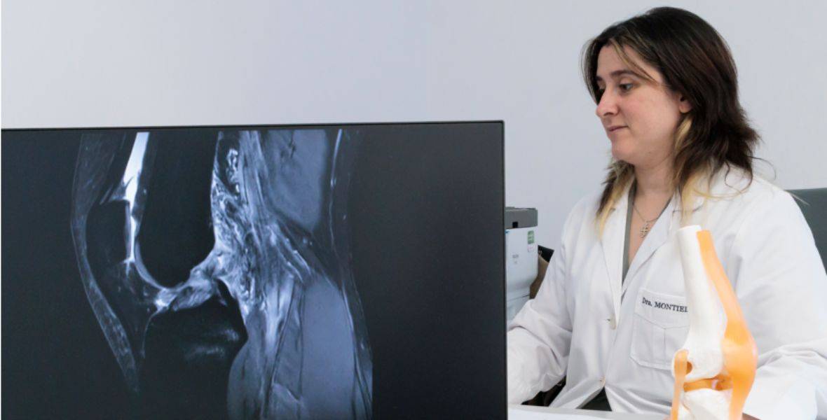 Foto de la Dra. Verónica Montiel, doctora del Departamento de Cirugía Ortopédica y Traumatología de CUN, revisa una radiografía de una rodilla en la sede de Madrid. 