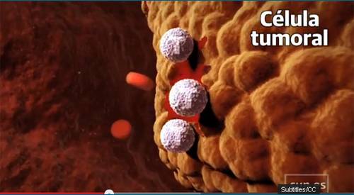 <p>Imagen de tratamiento de inmunoterapia para el glioblastoma</p>
