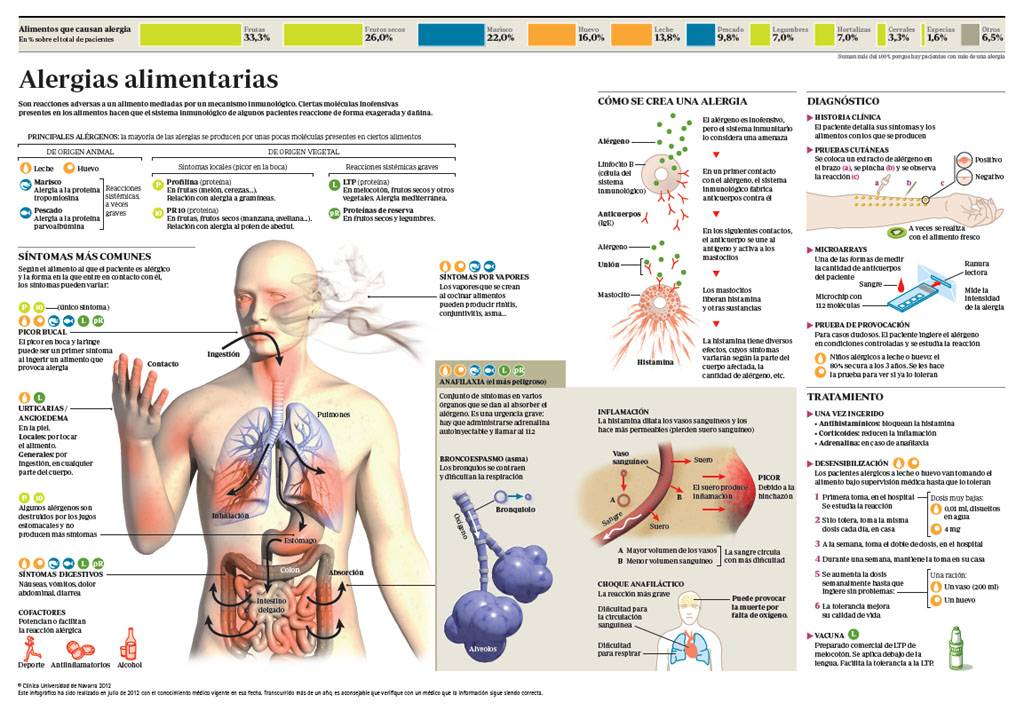 Infografía con toda la información sobre las alergias alimentarias