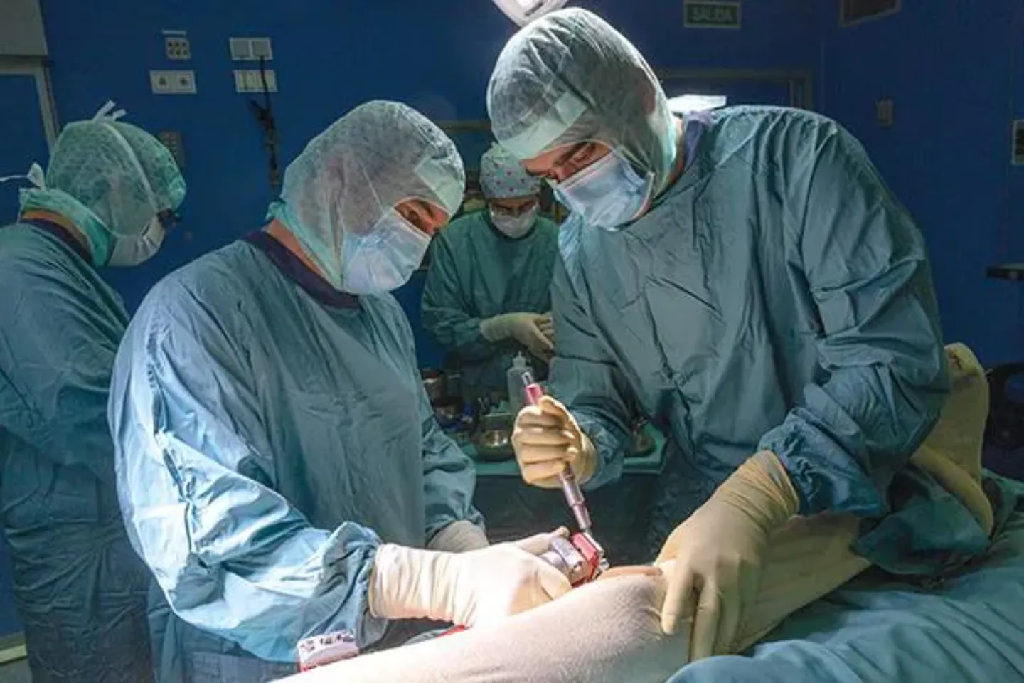 Cirugía fijador óseo. Traumatología. CUN Imagen de una cirugía con fijador óseo. Traumatología. Clínica Universidad de Navarra
