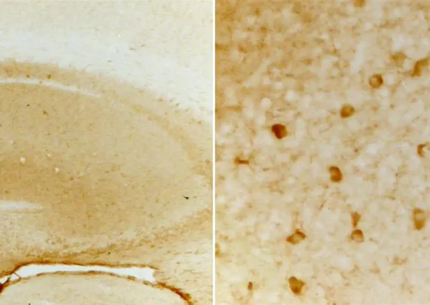 Tejido cerebral al microscopio. Clínica Universidad de Navarra Imagen al microscopio de tejido cerebral. Cima y Clínica Universidad de Navarra