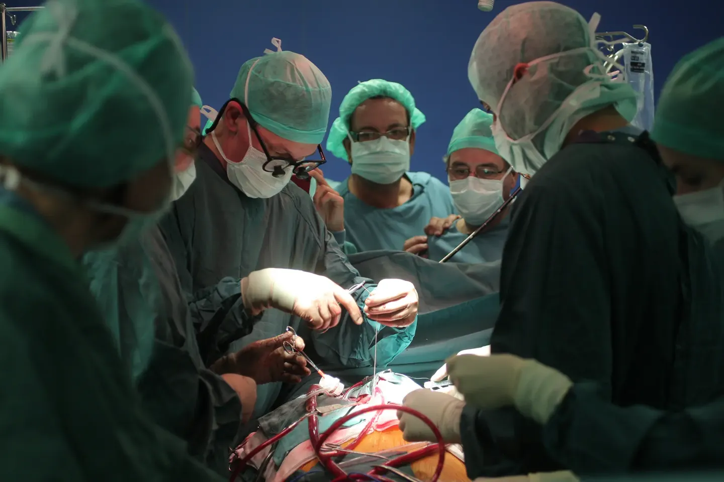 Imagen de un quirófano con varios médicos durante un trasplante de corazón en 2011 en la Clínica Universidad de Navarra.