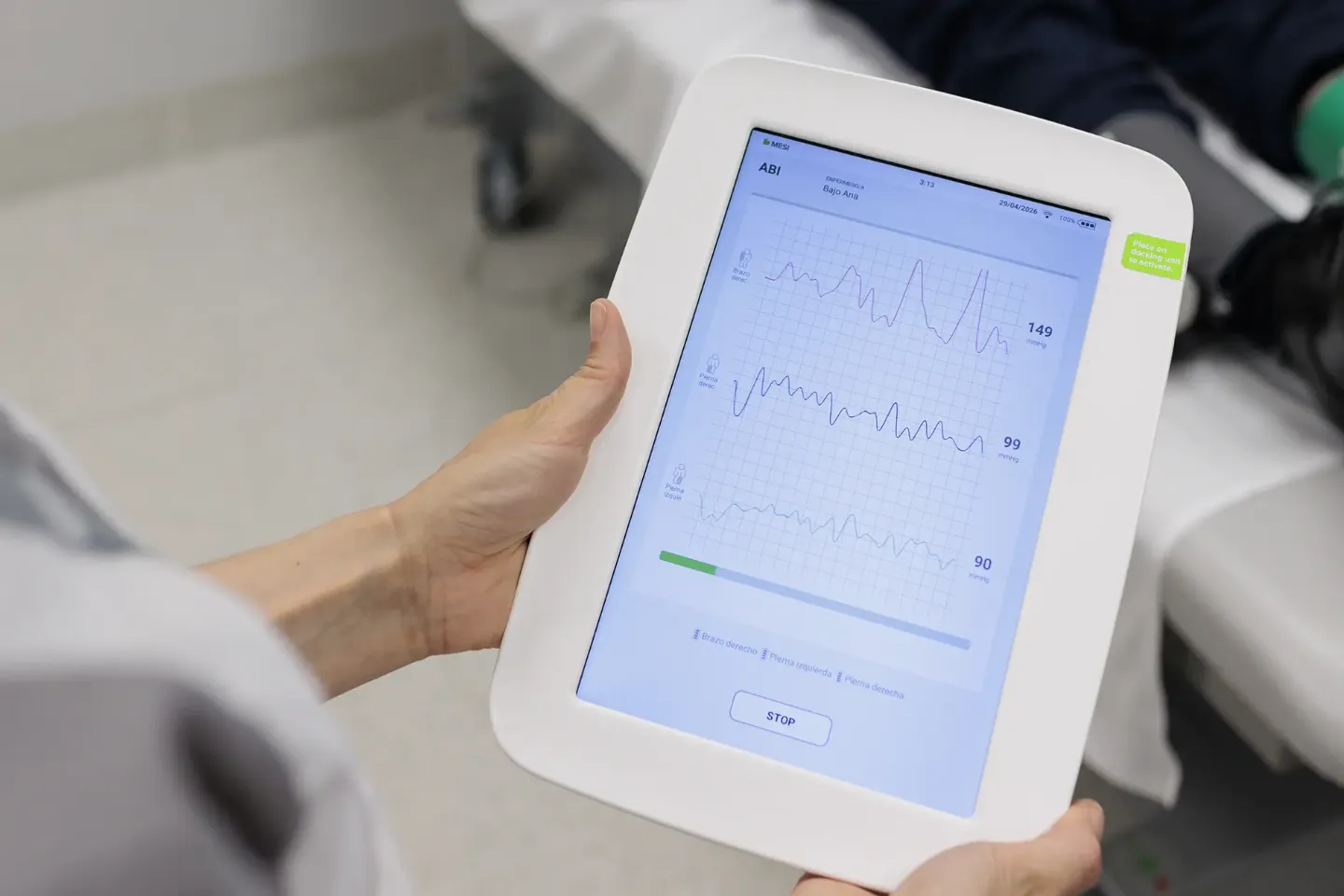 Imagen de la pantalla de una tablet, sujetada por una enfermera, donde se muestran los valores cardiológicos de un paciente tumbado en una camilla.