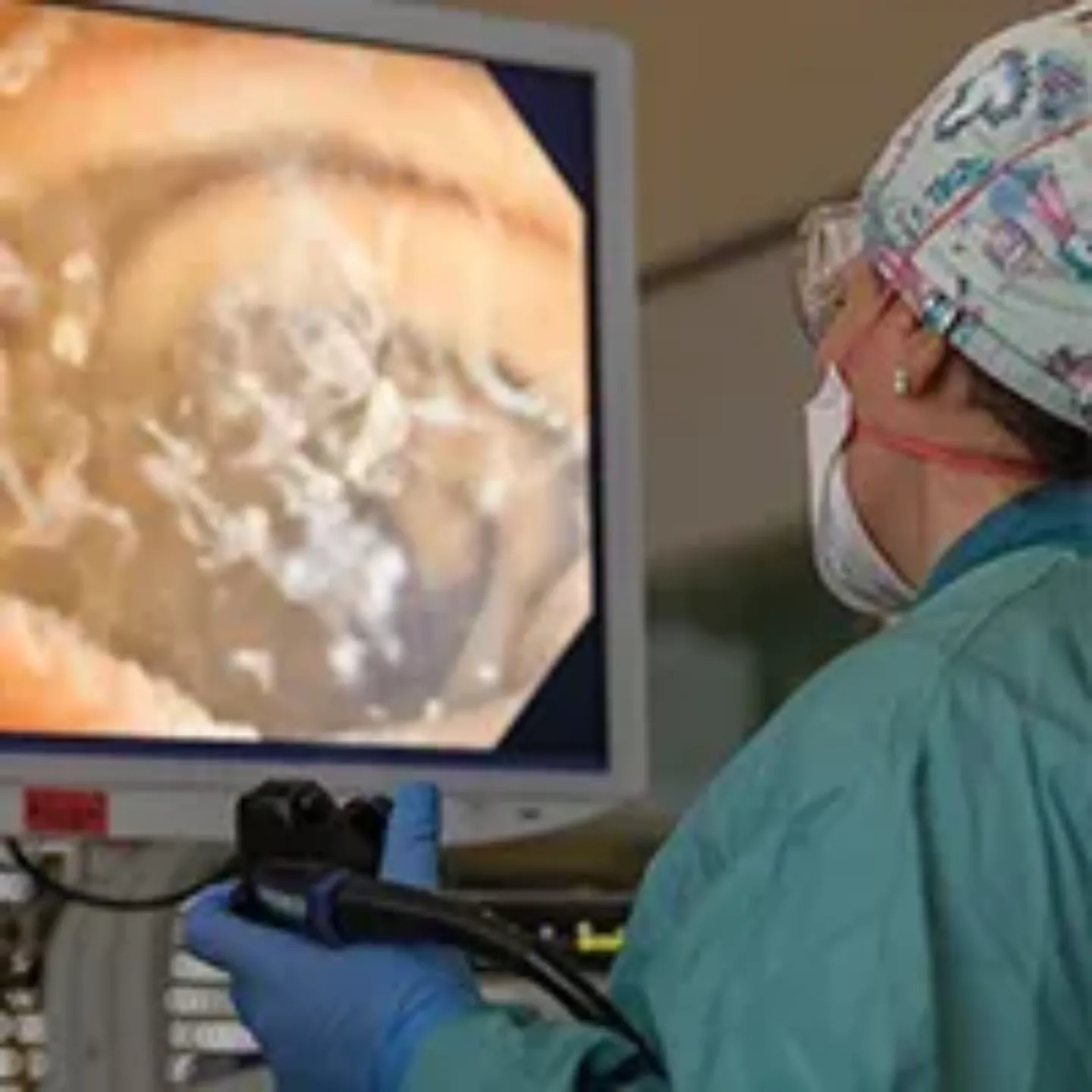 Imagen de la enteroscopia espiral motorizada para visualizar el tubo digestivo. Clínica Universidad de Navarra