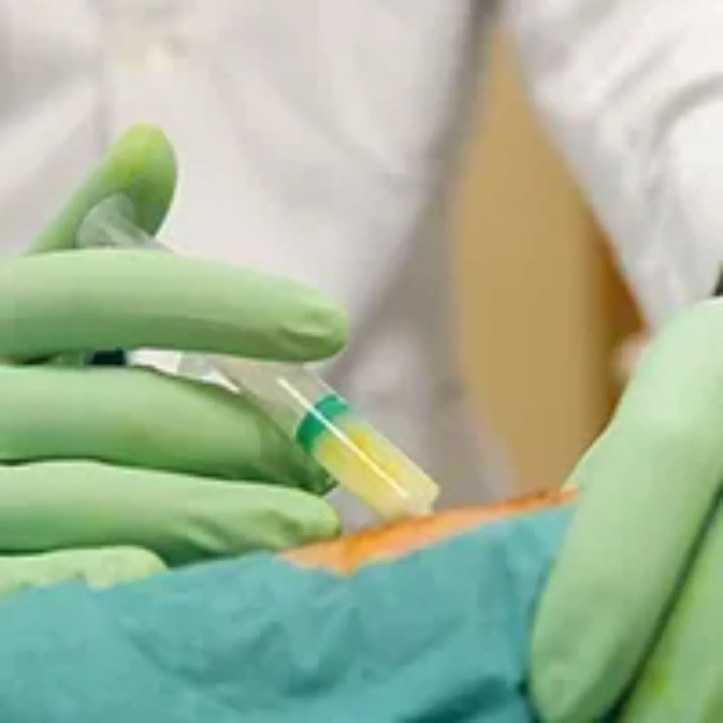 Imagen inyección terapia celular en artrosis de rodilla. Clínica Universidad de Navarra