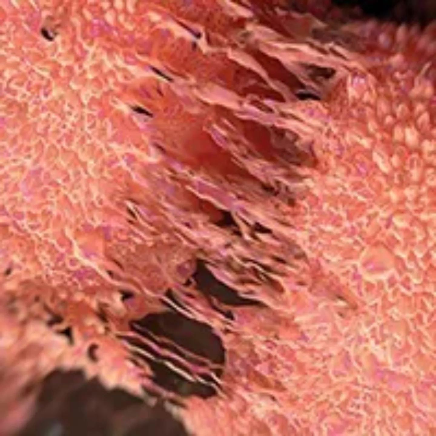 Imagen al microscopio de una división celular en el cáncer de próstata. Clínica Universidad de Navarra