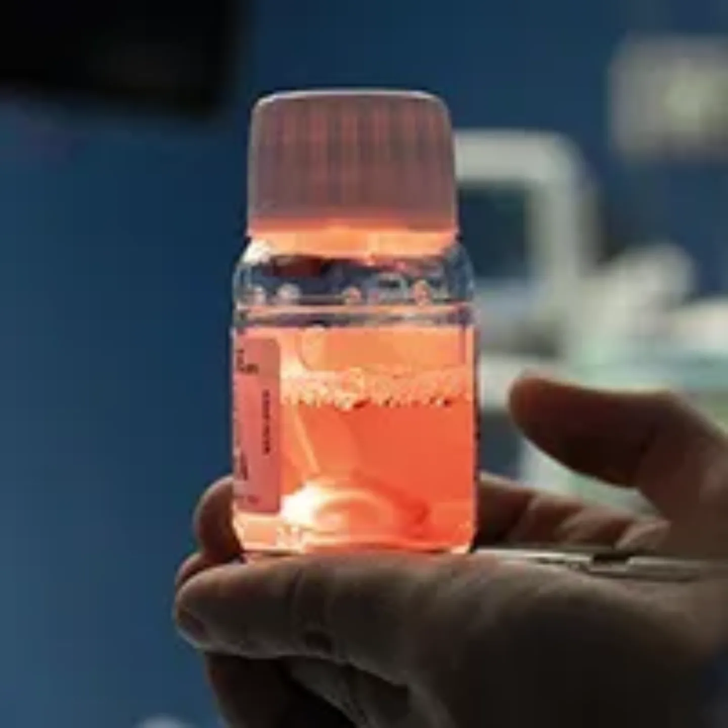 Imagen córnea para trasplante lamelar corneal. Clínica Universidad de Navarra