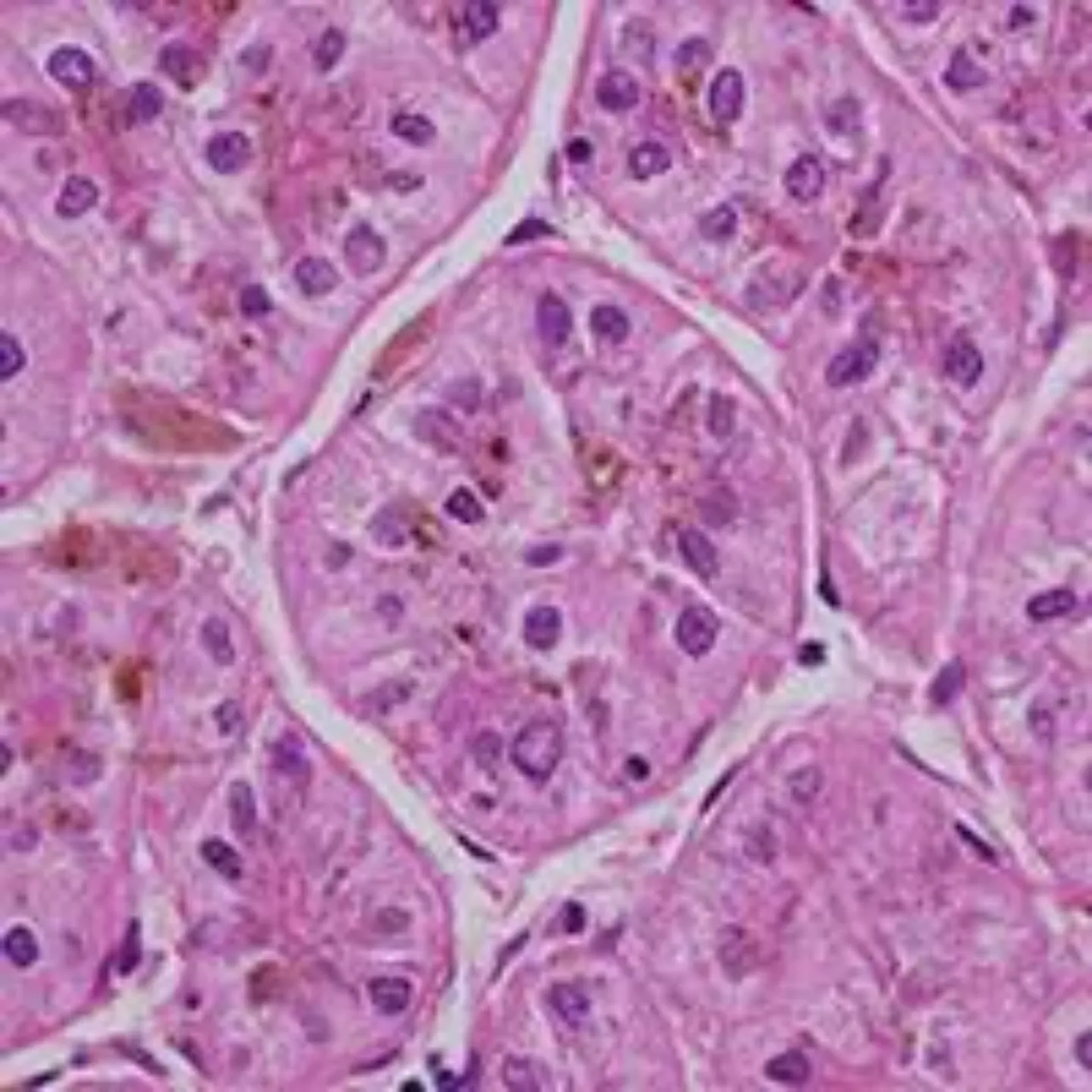 Imagen un tejido hepático al microscopio. Clínica Universidad de Navarra