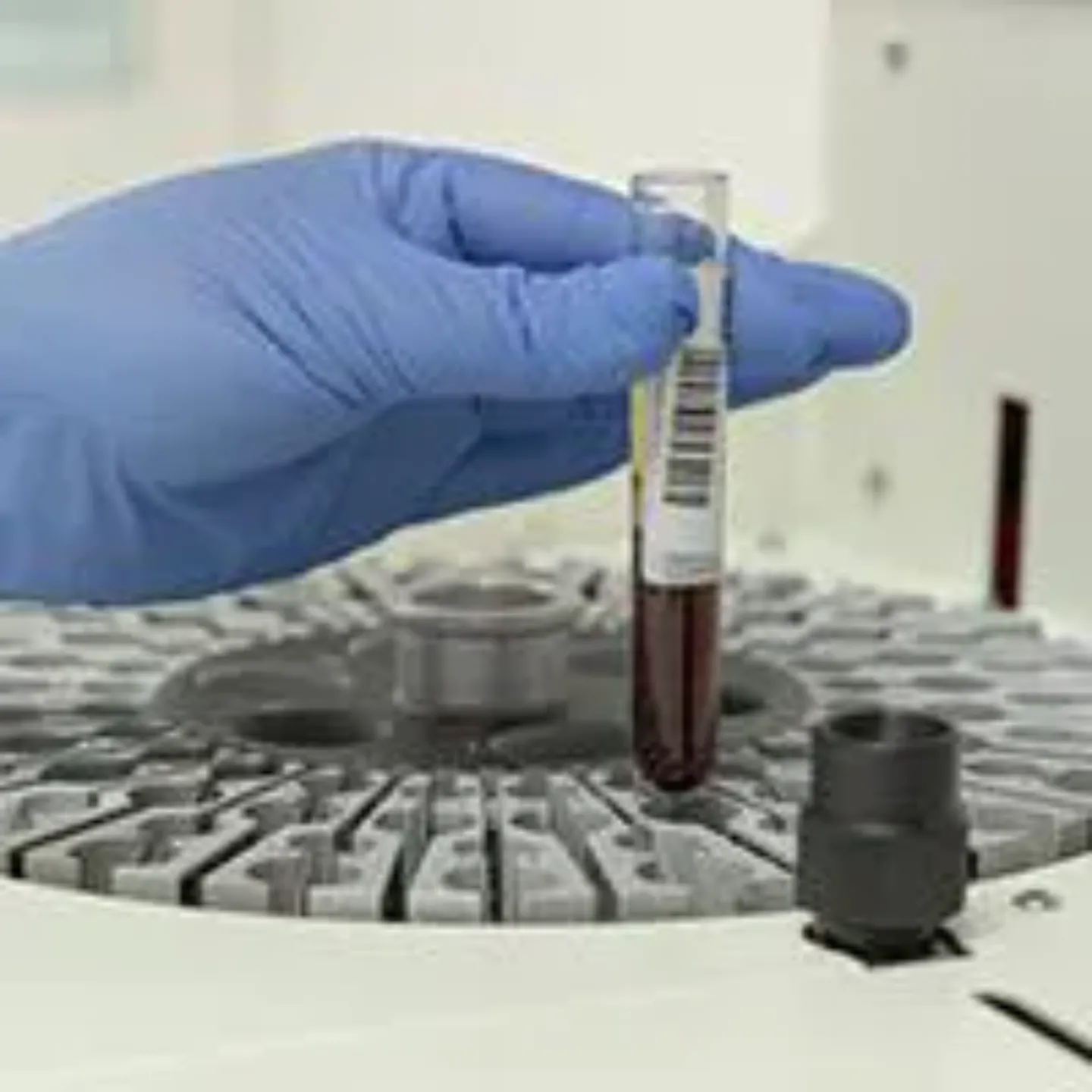 Imagen de las pruebas en el estudio Savin, inmunidad contra el Covid. Clínica Universidad de Navarra