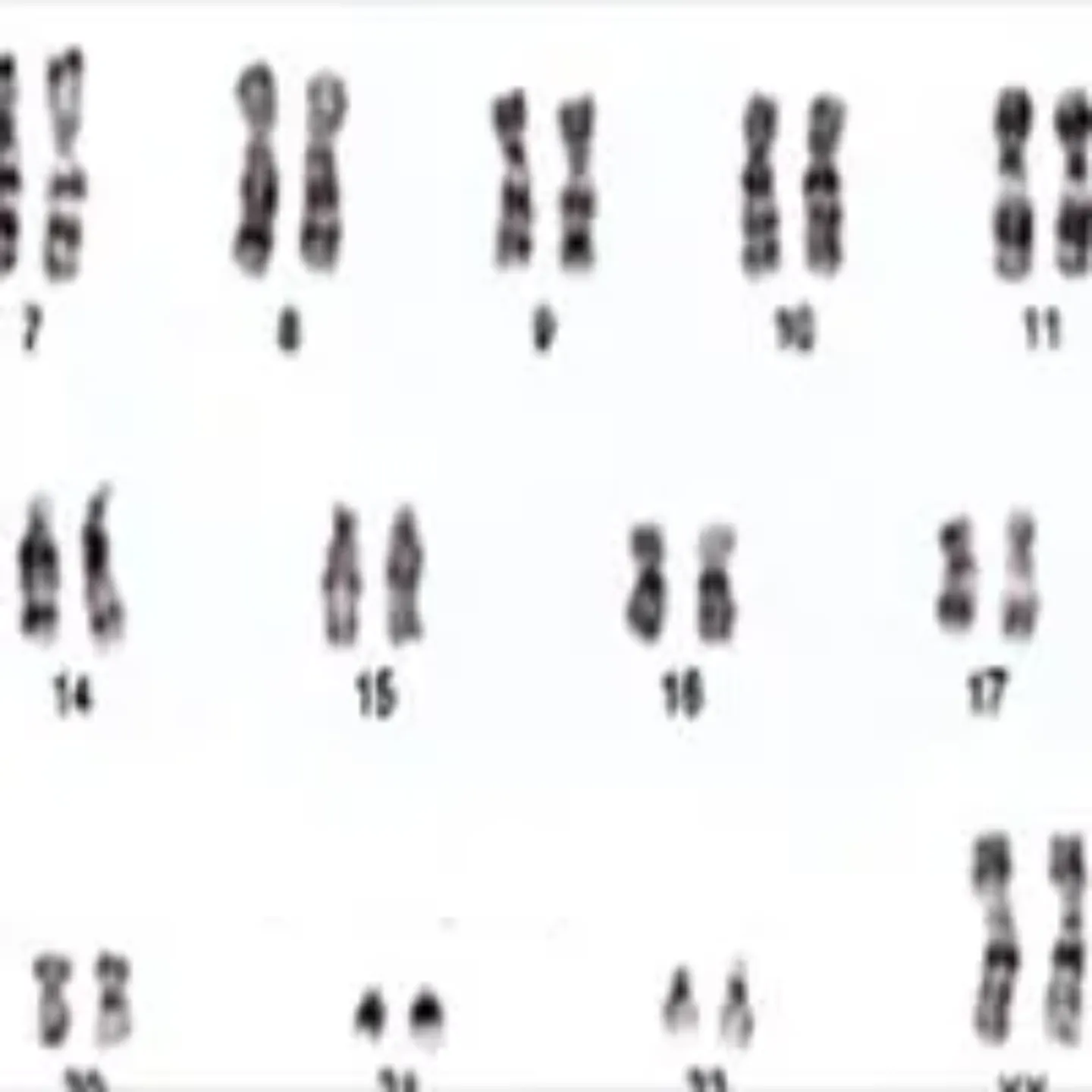 Imagen cromosomas. Pruebas moleculares en Cima Lab Diagnostics.