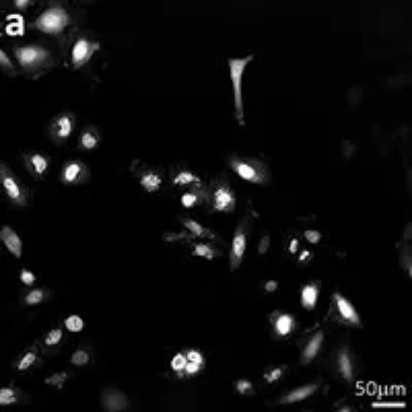 Imagen al microscopio de células, inteligencia artificial para estudiar su movimiento. Clínica Universidad de Navarra
