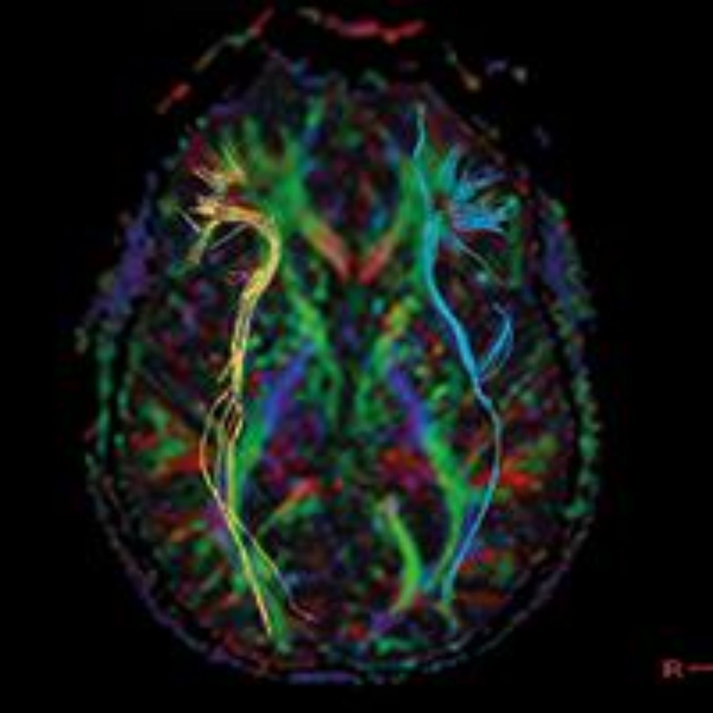 Imagen de miniatura del editorial.