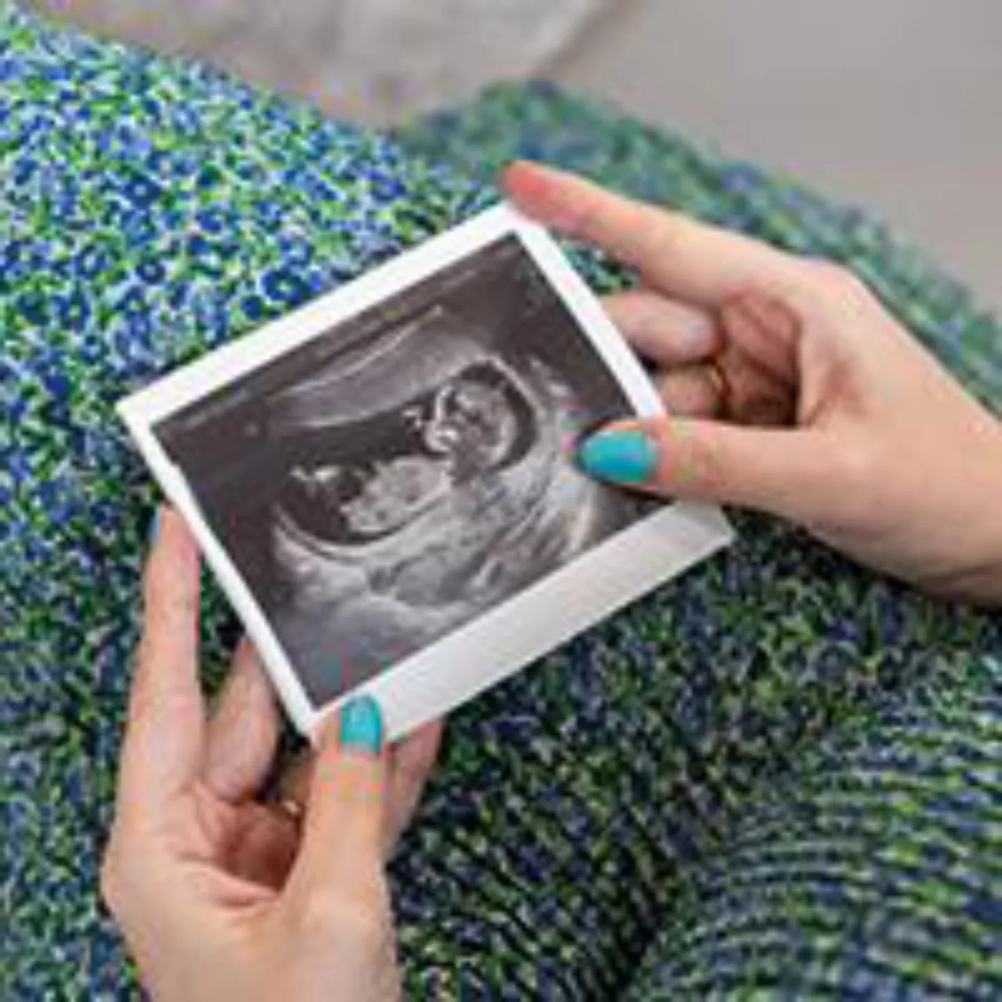 Miniatura para el editorial de la revista 128.