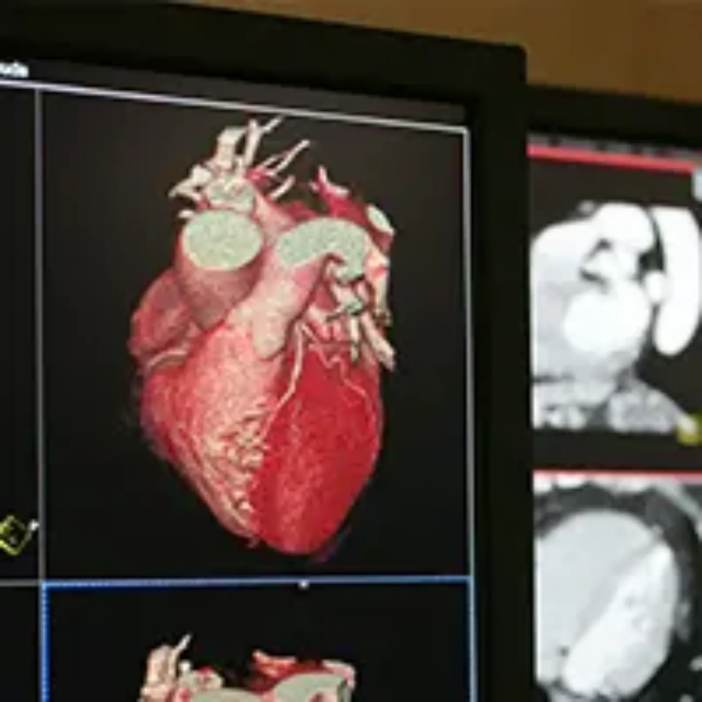 Imagen tridimensional de un corazón en una pantalla de ordenador. 