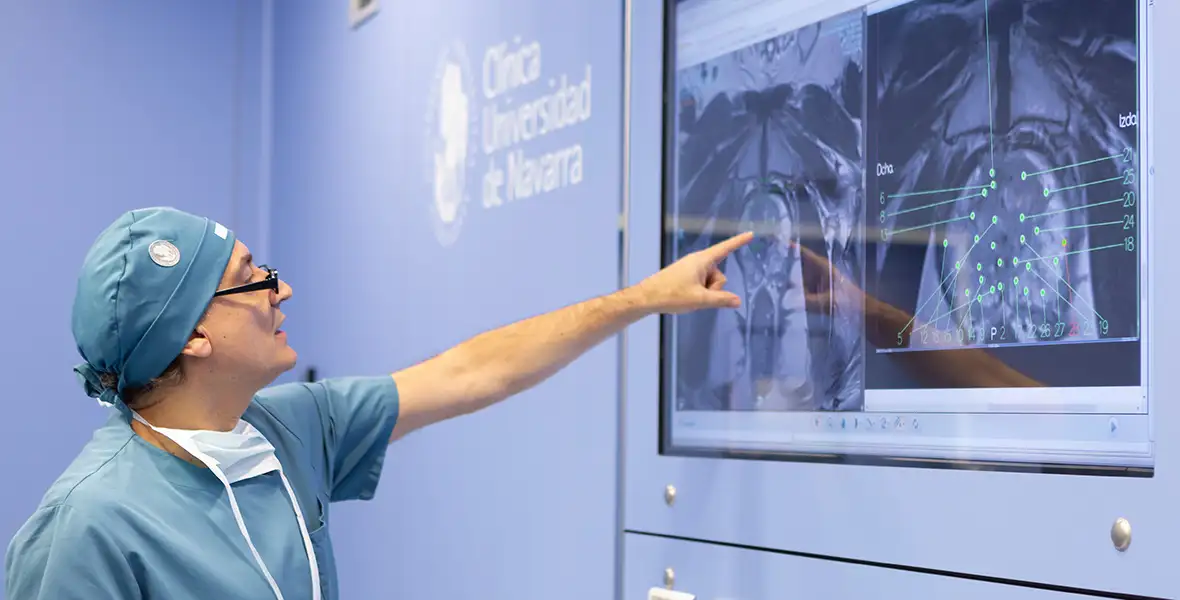 Electroporación irreversible. Cáncer de Próstata. Clínica Universidad de Navarra