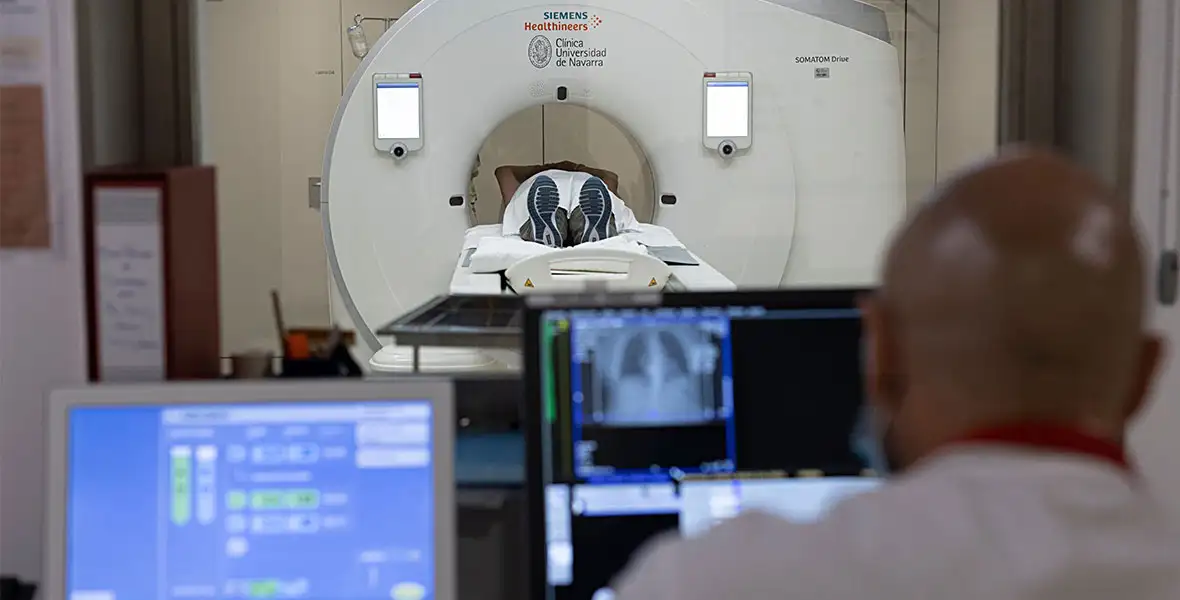TAC cáncer de pulmón. Clínica Universidad de Navarra
