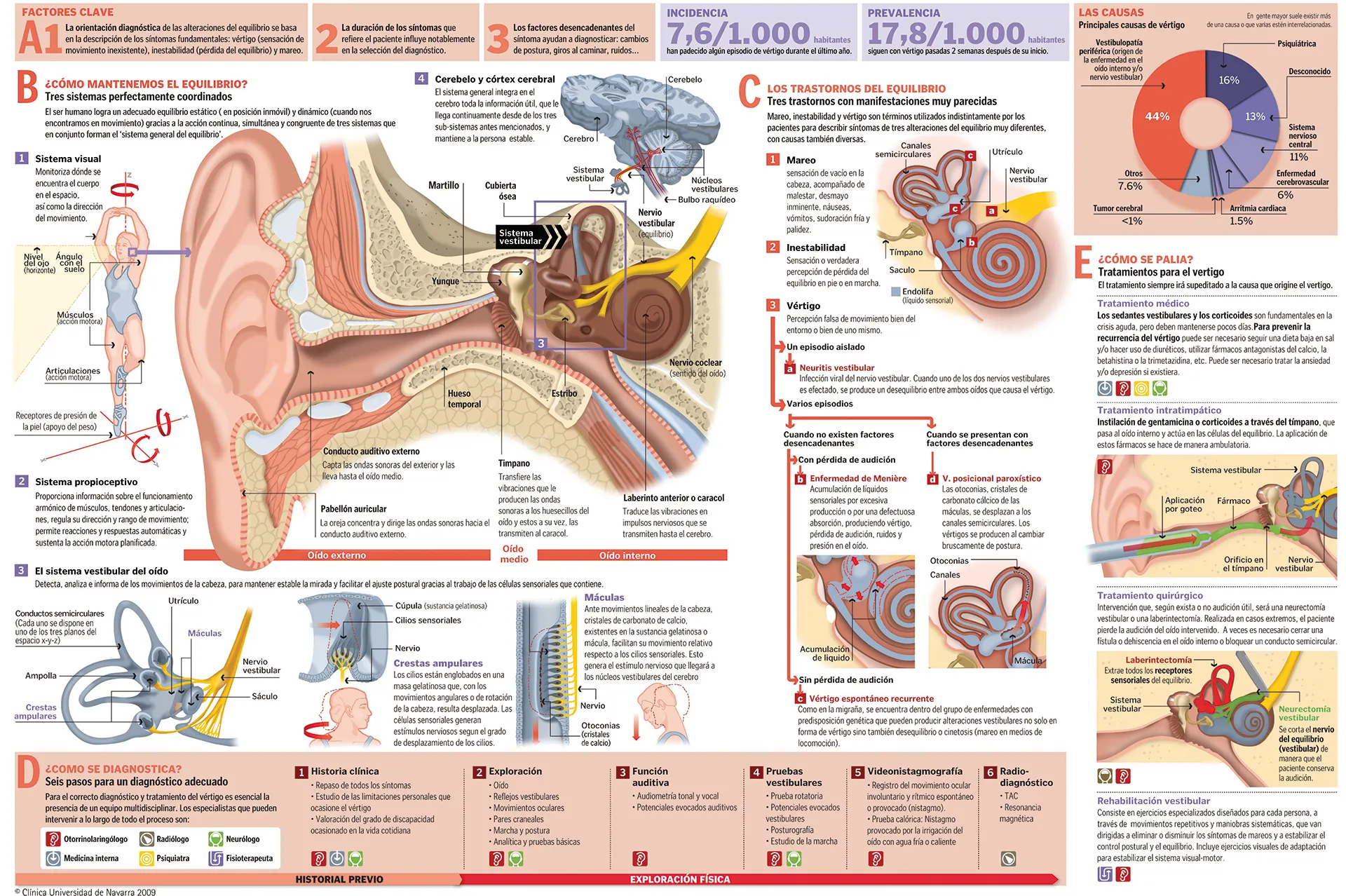 Infografía con toda la información sobre los trastornos del equilibrio
