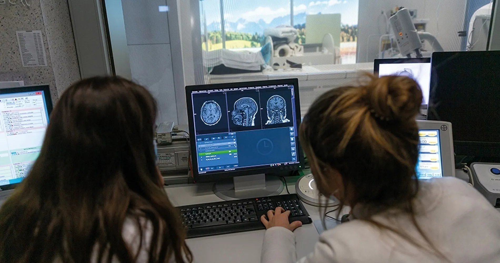 Detección precoz en la enfermedad de Meniere. Clínica Universidad de Navarra Imagen de imágenes obtenidas mediante resonancia magnética 3 teslas de la Clínica Universidad de Navarra