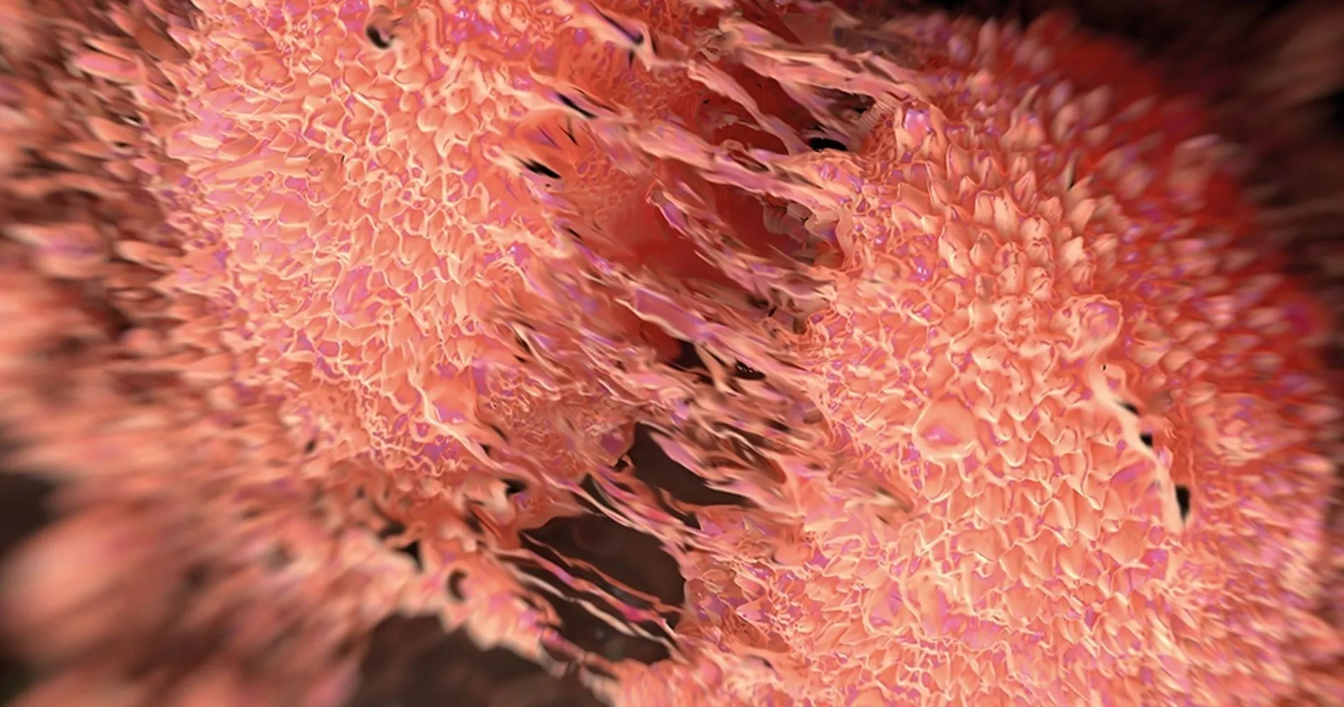 Células tumorales del cáncer de próstata. Clínica Universidad de Navarra Imagen de células tumorales replicándose en el cáncer de próstata. Clínica Universidad de Navarra