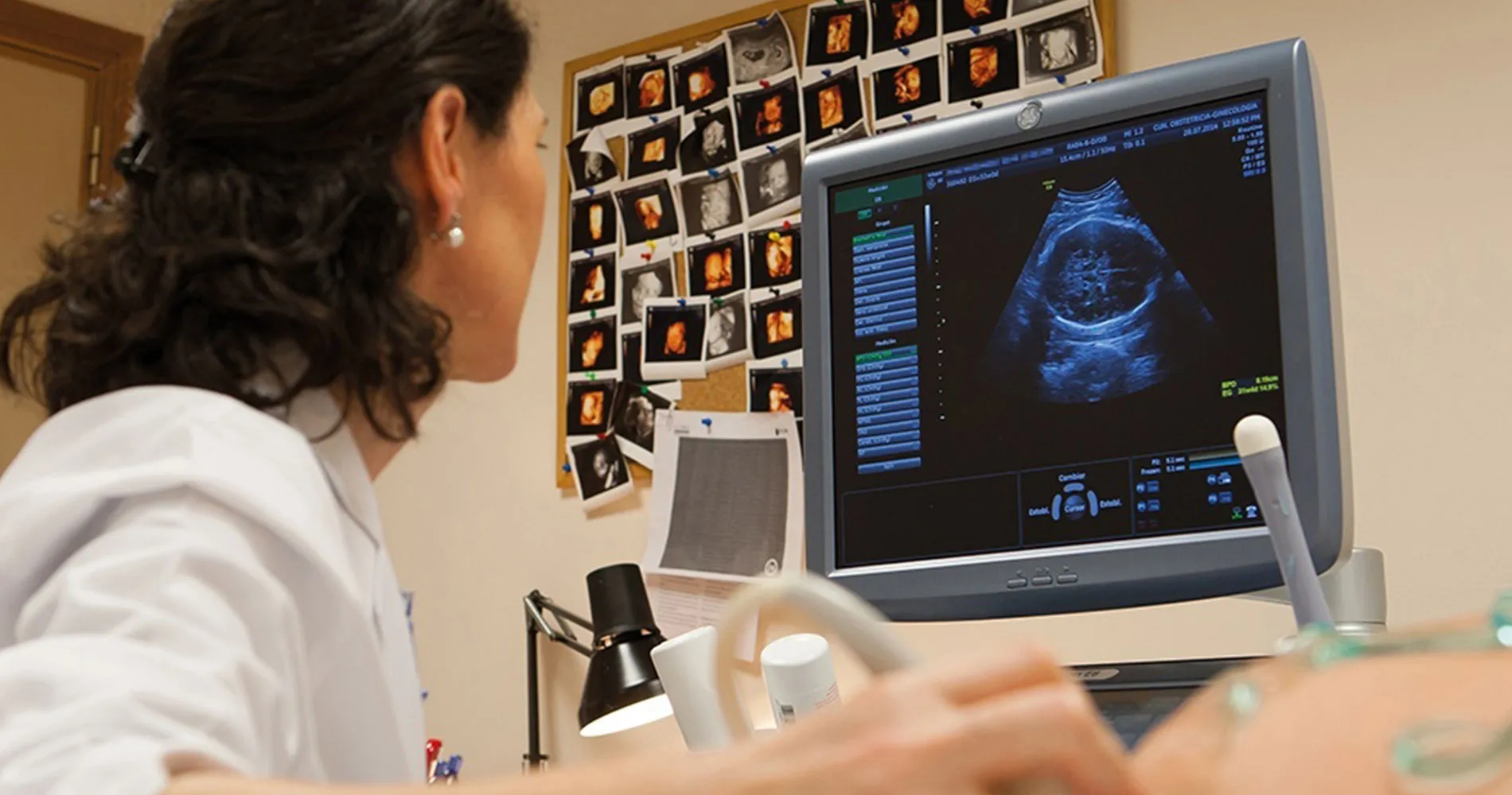Dra. Tania Errasti. Unidad Fertilidad. Clínica Universidad de Navarra Imagen de la Dra. Tania Errasti realizando una ecografía obstétrica en la Unidad de Fertilidad de la Clínica Universidad de Navarra