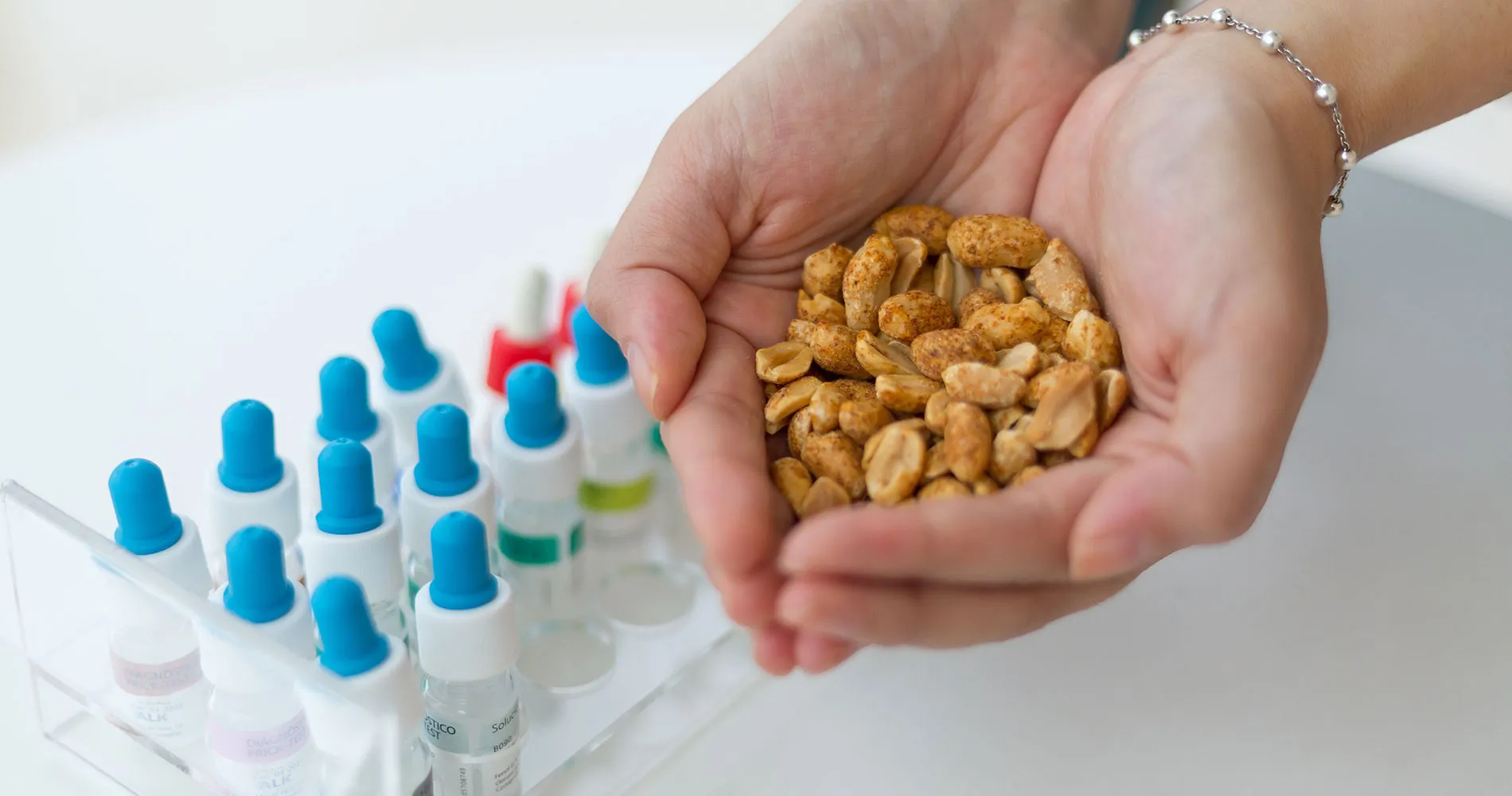 Imagen unas manos con cacahuetes y pruebas de alergia. Clínica Universidad de Navarra.