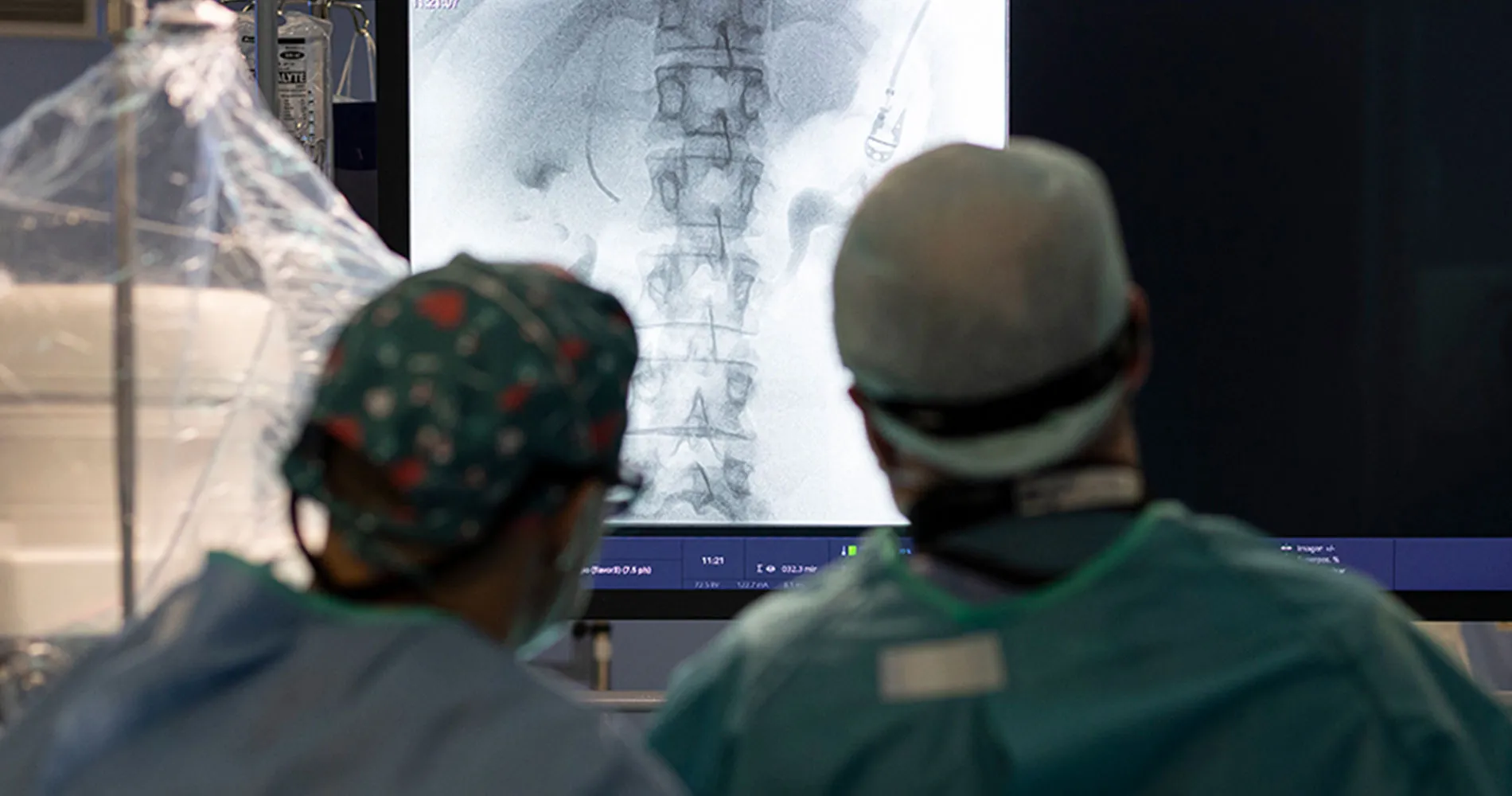 Tratamiento endovascular de las varices pélvicas. CUN Imagen del tratamiento de radiología vascular de las varices pélvicas. Clínica Universidad de Navarra.